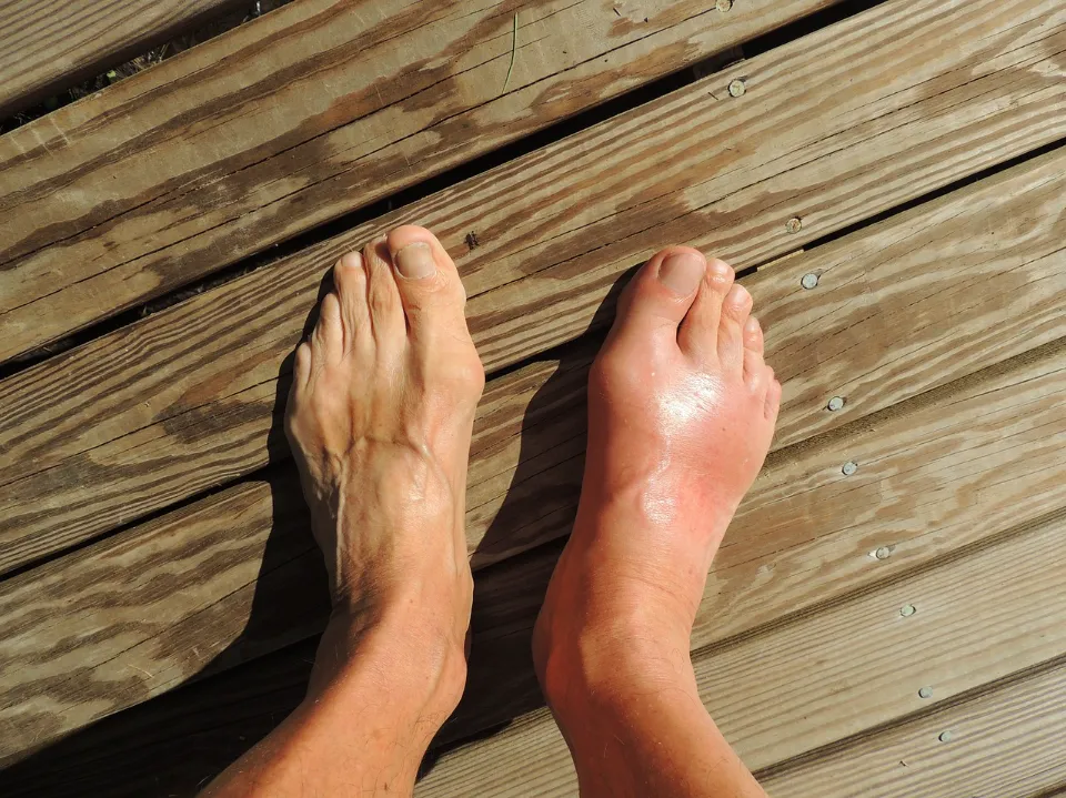 Old Man Feet: Common Problems&how to Care