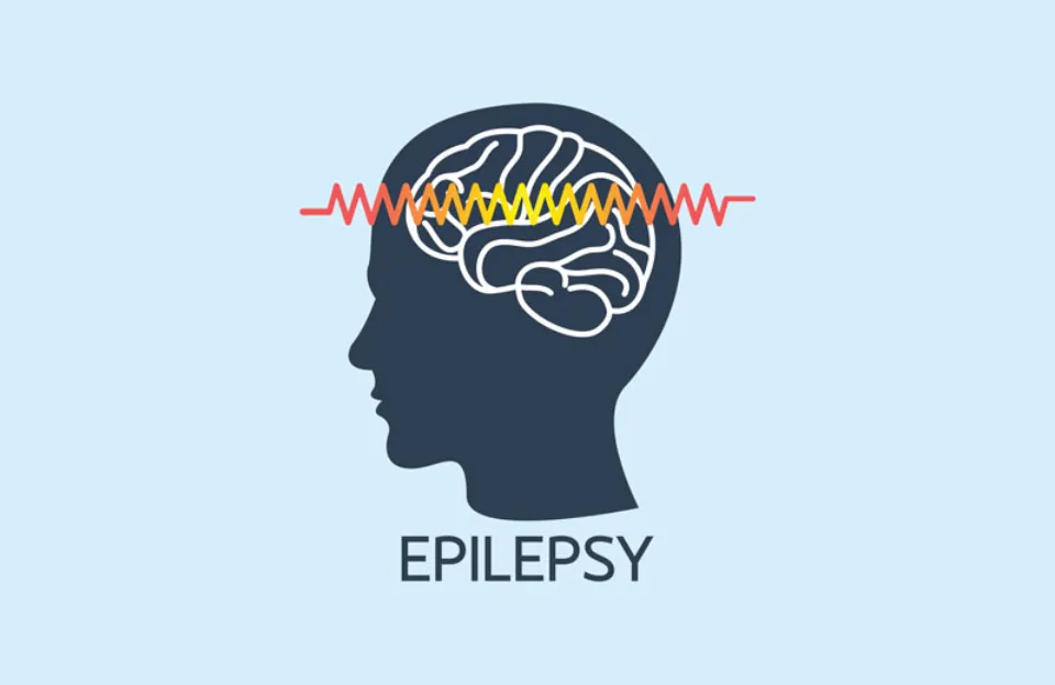 Epilepsy and Memory: Seizures Can Cause Memory Loss, and Brain-Mapping