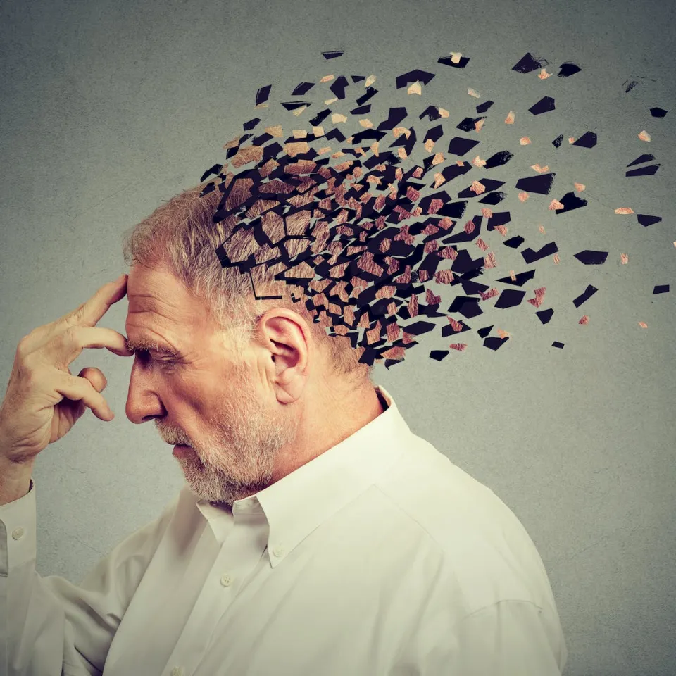 How Does Alzheimer's Kill You: Things You Must Know