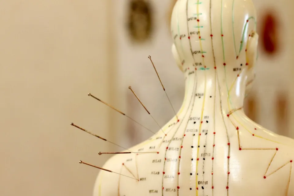 how-many-acupuncture-points-are-there-solved-elder-vip