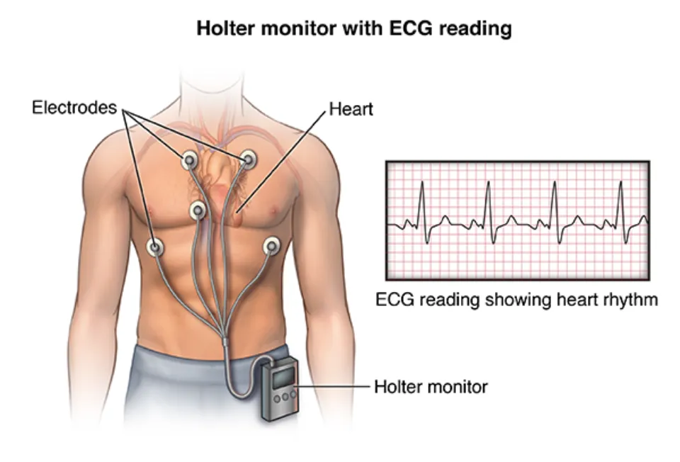 With a Heart Monitor: Can You Shower?