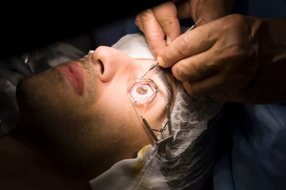 How Long Does Lasik Eye Surgery Last? (2023 Solved)