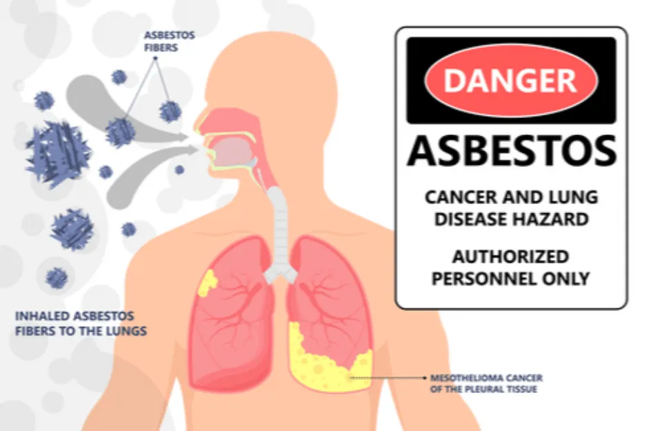 How Much Exposure to Asbestos Causes Cancer? (2023 Solved)